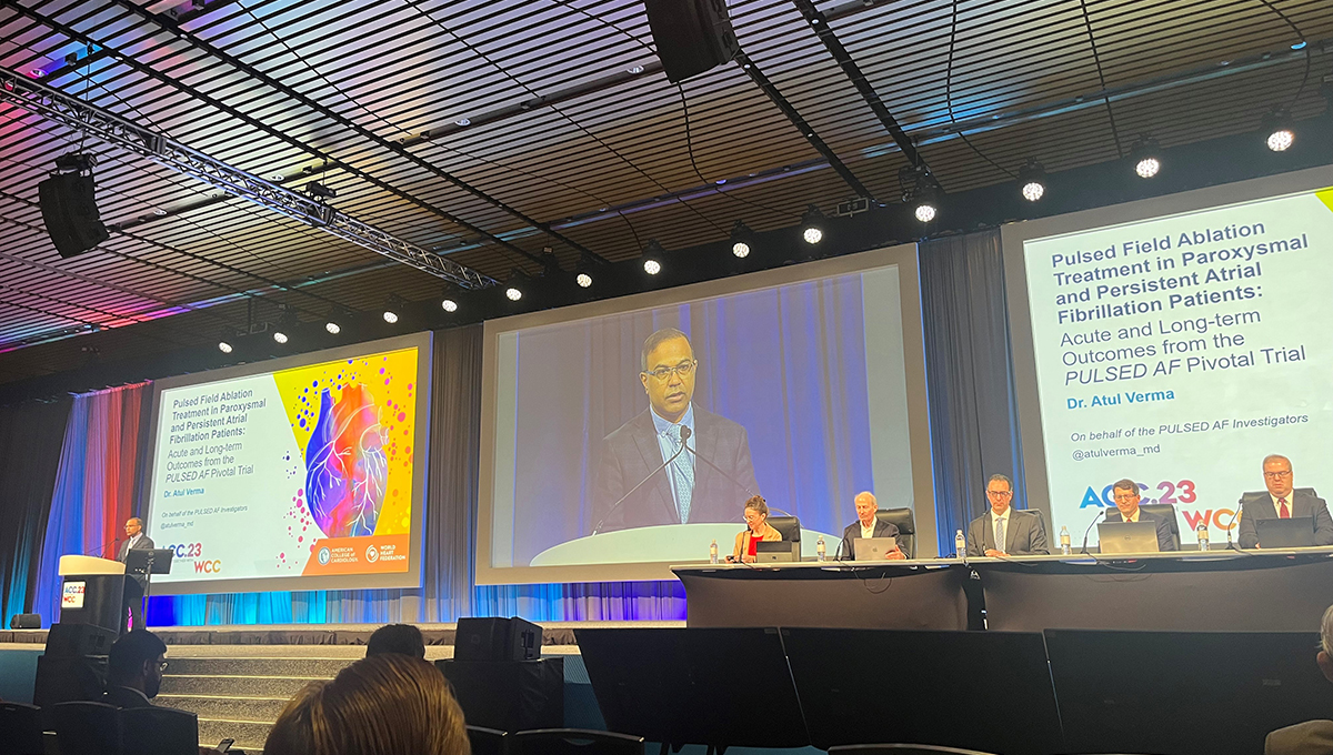 PULSED AF 'Strengthens the Case' for Pulsed-Field Ablation in AF - Vimarsana News