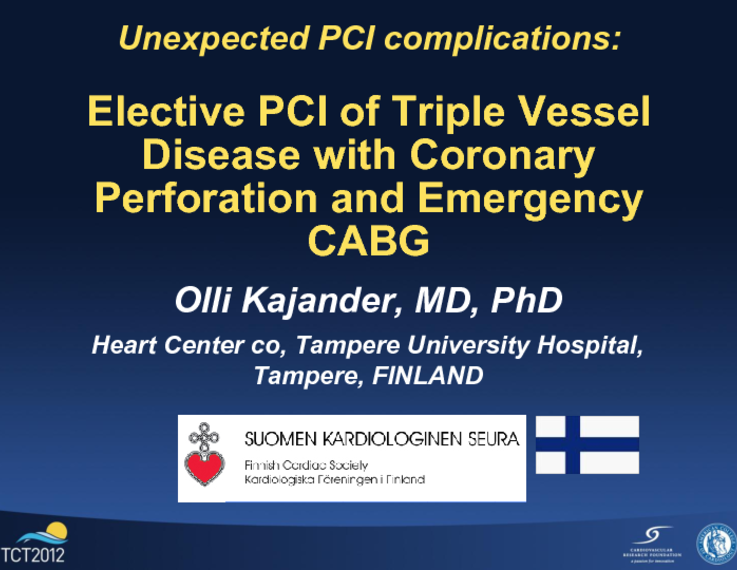 Elective PCI of Triple Vessel Disease with Coronary Perforation and  Emergency CABG 