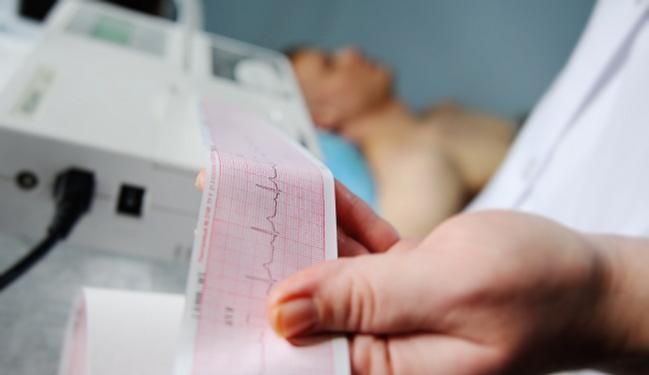 Do Not Screen Asymptomatic Adults For CVD With ECGs, Says USPSTF