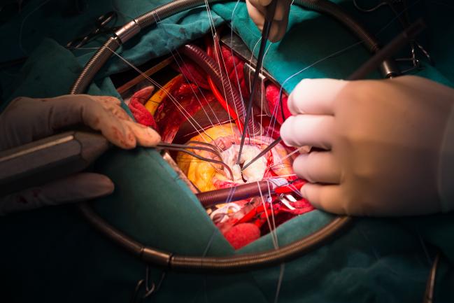 STS Data: Mitral Valve Cases Are Fastest-Growing Surgical Intervention in North America
