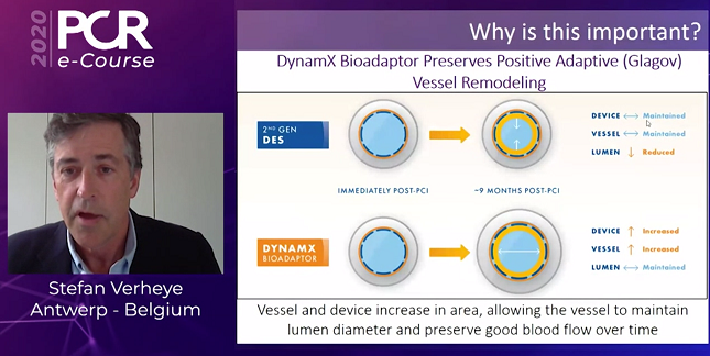 DynamX Bioadaptor Provides Promising Preliminary Results for De Novo Coronary Lesions