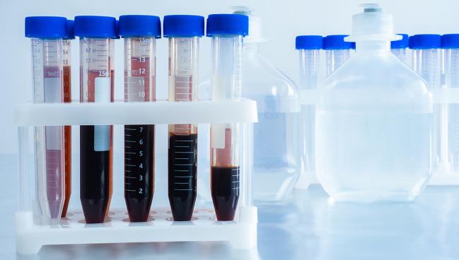 Higher Single-Sample hs-cTnT Threshold Can Safely Exclude MI