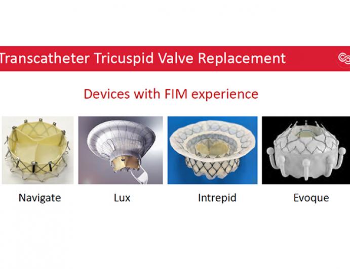 Recent Advances in Transcatheter Tricuspid & Mitral Valve Replacement
