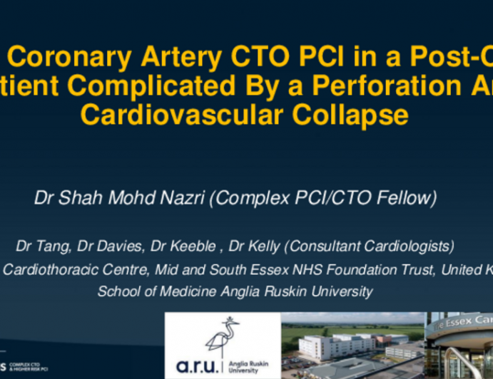 Right Coronary Artery CTO PCI in a Post-CABG Patient Complicated by a Perforation and Cardiovascular Collapse