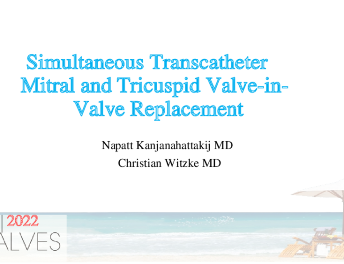 Simultaneous Transcatheter Mitral and Tricuspid Valve-in-Valve Replacement