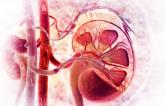 Untreated Accessory Arteries Dampen Renal Denervation Response: RADIANCE-HTN SOLO